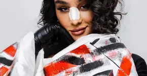 Conheça a cirurgia de feminização facial feita por Linn da Quebrada