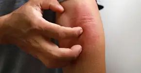 Foto: (iStock/Thai Liang Lim)