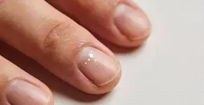 Foto: (Imagem sem texto alternativo disponivel ID [2680716])