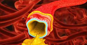 Alimento rico em antioxidantes é poderoso contra o colesterol alto