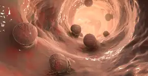 Câncer colorretal em jovens pode estar relacionado ao consumo deste alimento