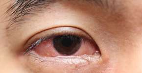 Foto: (Getty Images/iStockphoto)