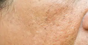 Foto: (Srisakorn/istock)