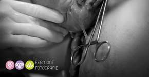 Fotos captam o exato momento em que os bebês despontam no mundo