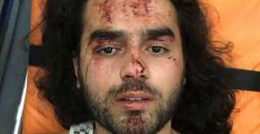 Jovem gay fica gravemente ferido após ser atacado por 30 pessoas