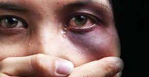 Foto: (Imagem sem texto alternativo disponivel ID [1761957])