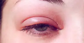 Foto: (iStock/Andrei310)