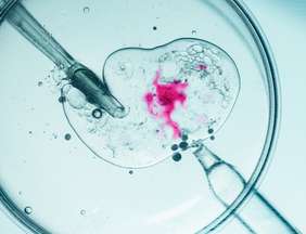 Bem estar: Fertilização in Vitro: 8 informações essenciais para entender o tratamento