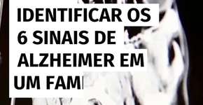 Como identificar os 6 sinais de Alzheimer em um familiar