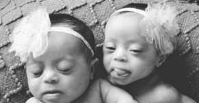 Foto: (Imagem sem texto alternativo disponivel ID [1120755])