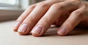 O melhor tratamento para unhas que descamam é este aqui