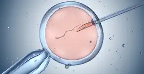 Busca por inseminação caseira cresce 80%, mas especialistas alertam para riscos de saúde e insegurança jurídica