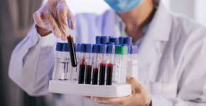 Foto: (Marcus Chung/istock)