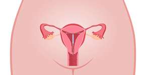 DIU de cobre, prata e hormonal: vantagens, desvantagens e preços