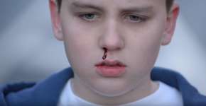 Garoto mostra em vídeo marcas físicas do cyberbullying