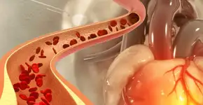 Estas são as dicas para controlar o colesterol ruim