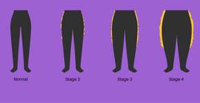 Foto: (Pikovit44/istock)