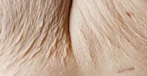 Ex-obesa faz ensaio fotográfico para narrar sua perda de peso