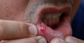 Foto: (Sidney de Almeida/istock)