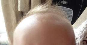 Foto: (Imagem sem texto alternativo disponivel ID [916655])