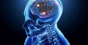 Foto: (iStock/nopparit)