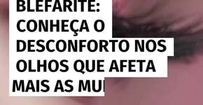 Blefarite: conheça o desconforto nos olhos que afeta mais as mulheres e como evitar