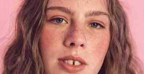 Modelo é comparada a Ronaldo Fenômeno por sorriso