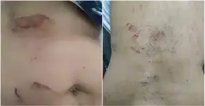 Homem tortura a mulher por ciúme e a faz comer pedaços de vidro