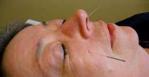 Foto: (Imagem sem texto alternativo disponivel ID [279274])