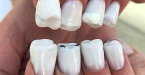 ‘Unhas de dentes’ provam que não há limites para a nail art