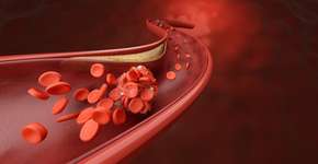 Fruta comum ajuda a regular nível de colesterol