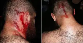 Estudante é agredido na UFPR por estar com boné do MST