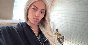 Os sintomas da doença crônica que afeta o cabelo de Beyoncé