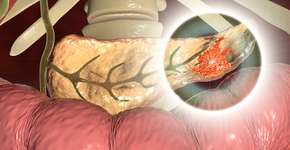 Foto: (Dr_Microbe/istock)