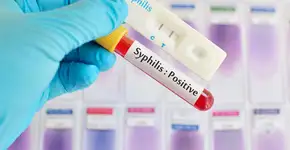 Foto: (jarun011/istock)