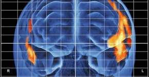 Foto: (Imagem sem texto alternativo disponivel ID [1894972])