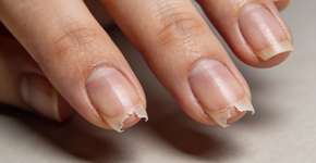 Foto: (Imagem sem texto alternativo disponivel ID [2697675])