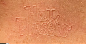 Marcas em corpos nus viram vídeo de animação stop motion