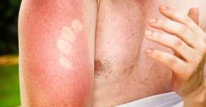 Foto: (NicolasMcComber/istock)