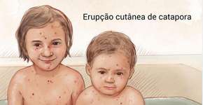 Foto: (Imagem sem texto alternativo disponivel ID [1835815])