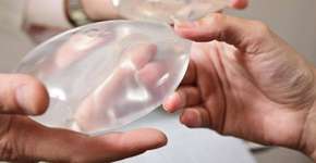 Anvisa proíbe venda de próteses Silimed