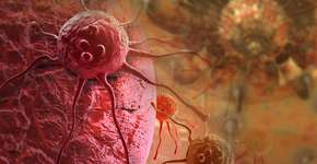 Foto: (iStock/vitanovski)