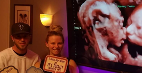 ‘Beijo’ de gêmeas durante ultrassom emociona pais e viraliza