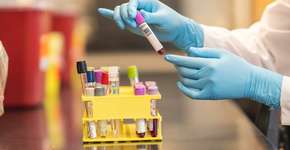 Foto: (Istock/FatCamera)