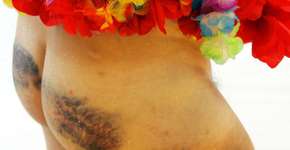 Jornalista denuncia violência de guardas municipais em bloco no RJ