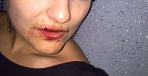 Tenente da PM golpeia médica com soco na boca após assediá-la