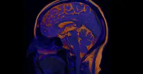 Estudo diz que consumo deste óleo vegetal reduz risco de demência