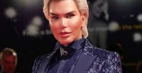 Ken Humano admite que pode perder o nariz após 11ª plástica