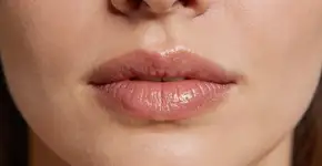 Foto: (Imagem sem texto alternativo disponivel ID [2728388])