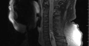 Foto: (Imagem sem texto alternativo disponivel ID [1834765])